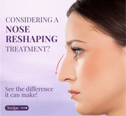 Nose Reshaping Treatment
